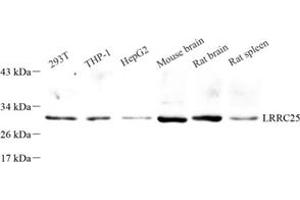 Western blot analysis of LRRC25 (ABIN7074482) at dilution of 1: 500 (LRRC25 anticorps)