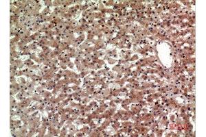 Immunohistochemistry (IHC) analysis of paraffin-embedded Human Liver, antibody was diluted at 1:100.