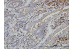 Immunoperoxidase of monoclonal antibody to BFAR on formalin-fixed paraffin-embedded human small Intestine.