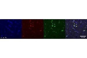 Immunohistochemistry (IHC) image for anti-Oligodendrocytic Myelin Paranodal and Inner Loop Protein (OPALIN) antibody (ABIN7456149) (OPALIN anticorps)