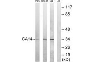 Western Blotting (WB) image for anti-Carbonic Anhydrase XIV (CA14) (AA 161-210) antibody (ABIN2890187) (CA14 anticorps  (AA 161-210))