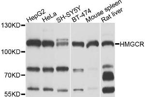 Western blot analysis of extracts of various cells, using HMGCR antibody.