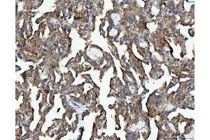 IHC analysis of EEF2 using anti-EEF2 antibody (ABIN7599561). (EEF2 anticorps  (AA 1-858))