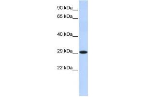Western Blotting (WB) image for anti-Hydroxysteroid (17-Beta) Dehydrogenase 14 (HSD17B14) antibody (ABIN2459984) (HSD17B14 anticorps)