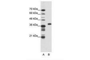 Image no. 1 for anti-Poly(rC) Binding Protein 1 (PCBP1) (AA 201-250) antibody (ABIN202334) (PCBP1 anticorps  (AA 201-250))