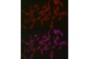 Immunofluorescence analysis of C6 cells using RIPK3 Rabbit pAb (ABIN6132598, ABIN6146964, ABIN6146967 and ABIN6221084) at dilution of 1:50 (40x lens).