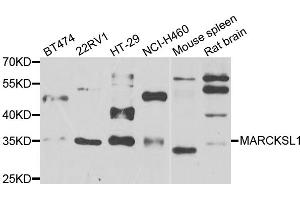 Western blot analysis of extracts of various cell lines, using MARCKSL1 antibody (ABIN5974290) at 1/1000 dilution.