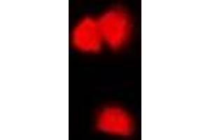 Immunofluorescent analysis of CASK staining in U2OS cells.