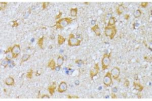 Immunohistochemistry of paraffin-embedded Mouse brain using EIF2B2 Polyclonal Antibody at dilution of 1:100 (40x lens). (EIF2B2 anticorps)