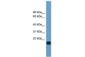 WB Suggested Anti-NT5M Antibody Titration: 0. (NT5M anticorps  (N-Term))