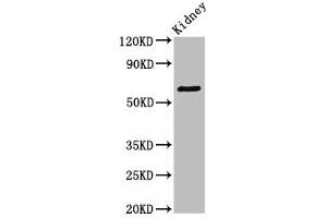 Western Blot Positive WB detected in: Mouse kidney tissue All lanes: GRK5 antibody at 3. (GRK5 anticorps  (AA 406-590))