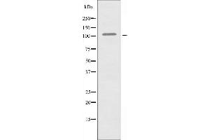Western blot analysis of extracts from COLO205 cells, using EPHA1 antibody. (EPHA1 anticorps  (Internal Region))