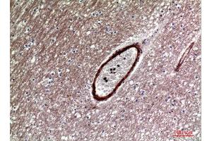 Immunohistochemistry (IHC) analysis of paraffin-embedded Human Brain, antibody was diluted at 1:100.