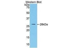 Western Blotting (WB) image for anti-Multimerin 1 (MMRN1) (AA 846-1084) antibody (ABIN1859864)