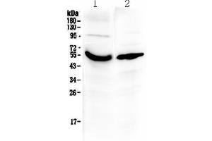 Western blot analysis of Vitamin D Binding protein using anti-Vitamin D Binding protein antibody . (Gc (AA 17-256) anticorps)