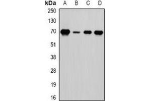 Western blot analysis of LTA4H expression in HepG2 (A), Romas (B), mouse spleen (C), mouse brain (D) whole cell lysates. (LTA4H anticorps)