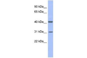 WB Suggested Anti-GAPDHS Antibody Titration:  0. (GAPDHS anticorps  (N-Term))