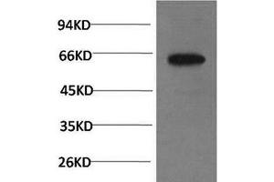 Western Blot analysis of PC-3 cells using Phospho-AKT1 (Ser473) Monoclonal Antibody at dilution of 1:1000 (AKT1 anticorps  (pSer473))