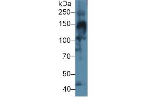 Western Blot; Sample: Mouse Skeletal muscle lysate; Primary Ab: 1µg/ml Rabbit Anti-Human COL4a3 Antibody Second Ab: 0. (COL4a3 anticorps  (AA 1428-1670))