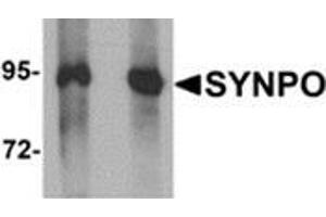 Western blot analysis of SYNPO in Rat brain tissue lysate with SYNPO antibody at (left) 1 and (right) 2 μg/ml. (SYNPO anticorps  (C-Term))