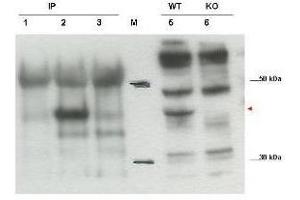 Western blot using  affinity purified anti-Cybr antibody shows detection of endogenous Cybr from mouse splenocytes using anti-Cybr antibody to immunoprecipitate and western blot (lanes 1-3). (CYTIP anticorps  (C-Term))