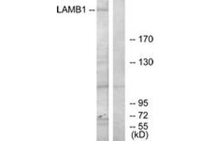 Western blot analysis of extracts from HepG2 cells, using LAMB1 Antibody. (Laminin beta 1 anticorps  (AA 1721-1770))