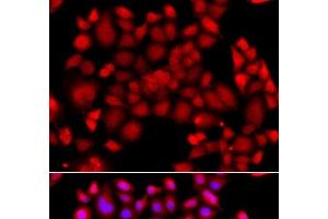 Immunofluorescence analysis of A549 cells using PIP4K2B Polyclonal Antibody (PIP4K2B anticorps)