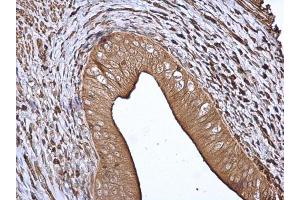 IHC-P Image 14-3-3 beta antibody [N1C2] detects 14-3-3 beta protein at cytoplasm in rat cervix by immunohistochemical analysis.