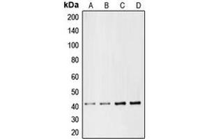Western blot analysis of CMKLR1 expression in Jurkat (A), HepG2 (B), mouse liver (C), rat liver (D) whole cell lysates. (CMKLR1 anticorps  (Center))