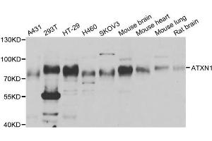 Western Blotting (WB) image for anti-Ataxin 1 (ATXN1) antibody (ABIN1882344)