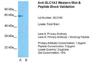 Host:  Rabbit  Target Name:  SLC1A2  Sample Type:  Fetal Brain  Lane A:  Primary Antibody  Lane B:  Primary Antibody + Blocking Peptide  Primary Antibody Concentration:  1ug/ml  Peptide Concentration:  5ug/ml  Lysate Quantity:  25ug/lane/Lane  Gel Concentration:  0.