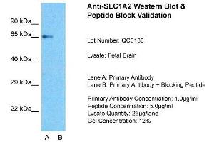 Host:  Rabbit  Target Name:  SLC1A2  Sample Type:  Fetal Brain  Lane A:  Primary Antibody  Lane B:  Primary Antibody + Blocking Peptide  Primary Antibody Concentration:  1ug/ml  Peptide Concentration:  5ug/ml  Lysate Quantity:  25ug/lane/Lane  Gel Concentration:  0. (SLC1A2 anticorps  (N-Term))