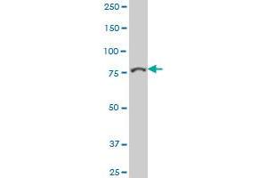 PTPRE polyclonal antibody (A01), Lot # 051017JC01 Western Blot analysis of PTPRE expression in Hela S3 NE .