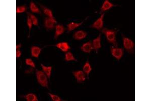 ABIN6272363 staining Hela by IF/ICC. (Nidogen 1 anticorps  (Internal Region))