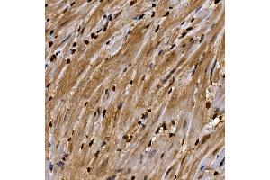 Immunohistochemistry of paraffin-embedded mouse spleen using AHR Rabbit pAb (ABIN3015499, ABIN3015500, ABIN5663909 and ABIN6218543) at dilution of 1:100 (40x lens).