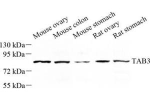 Western blot analysis of tab3 (ABIN7075877) at dilution of 1: 500 (TAB3 anticorps)