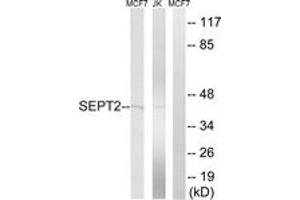 Western blot analysis of extracts from Jurkat/MCF-7 cells, using SEPT2 Antibody. (Septin 2 anticorps  (AA 103-152))