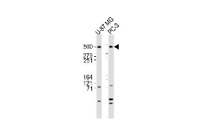 All lanes : Anti-DYNC1H1 Antibody (C-term) at 1:2000 dilution Lane 1: U-87 MG whole cell lysates Lane 2: PC-3 whole cell lysates Lysates/proteins at 20 μg per lane.