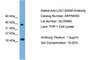 WB Suggested Anti-LOC152586  Antibody Titration: 0. (GL54D anticorps  (Middle Region))
