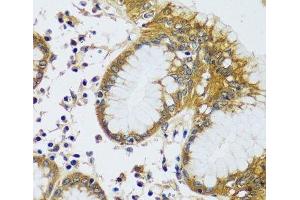 Immunohistochemistry of paraffin-embedded Human stomach using CAMLG Polyclonal Antibody at dilution of 1:100 (40x lens).