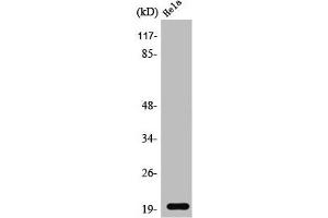 Western Blot analysis of Jurkat cells using SRp20 Polyclonal Antibody