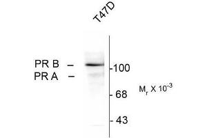 Western Blotting (WB) image for anti-Progesterone Receptor (PGR) (pSer294) antibody (ABIN371835) (Progesterone Receptor anticorps  (pSer294))