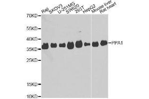 Western blot analysis of extracts of various cell lines, using PPA1 antibody. (Pyrophosphatase (Inorganic) 1 (PPA1) (AA 1-289) anticorps)