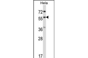 RANG Antibody (N-term) 3776a western blot analysis in Hela cell line lysates (35 μg/lane). (RANGAP1 anticorps  (N-Term))