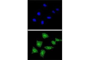 Confocal immunofluorescent analysis of SOD1 antibody with 293 cells followed by Alexa Fluor 488-conjugated goat anti-rabbit lgG (green).