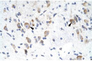 Human Brain; Rabbit Anti-GTF2F2 Antibody. (GTF2F2 anticorps  (Middle Region))