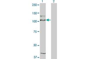 Western Blot analysis of KIT expression in transfected 293T cell line by KIT monoclonal antibody (M04), clone 1G1. (KIT anticorps  (AA 41-140))