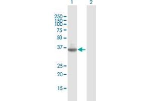 Western Blot analysis of TMIGD2 expression in transfected 293T cell line by TMIGD2 MaxPab polyclonal antibody. (TMIGD2 anticorps  (AA 1-282))