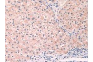 IHC-P analysis of Human Liver Tissue, with DAB staining. (Fibronectin anticorps  (AA 313-607))