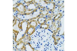 Immunohistochemistry of paraffin-embedded mouse kidney using GDAP1 antibody. (GDAP1 anticorps  (AA 1-225))